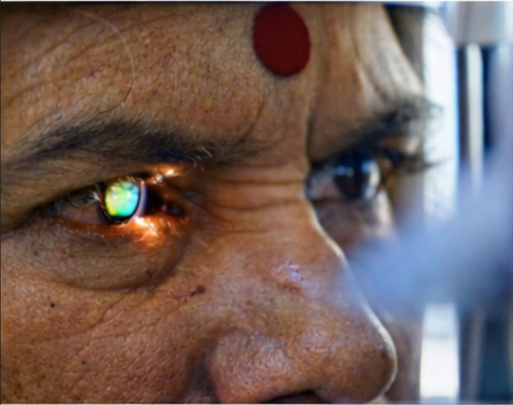 Close up retina examination at Wankhade Netralaya